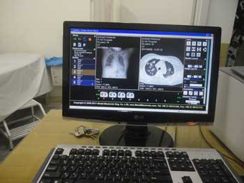 pacs system