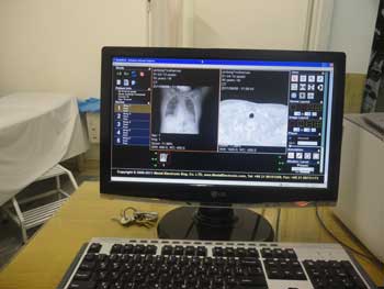 pacs system